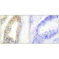 ZNF638 Antibody