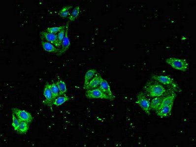 CBLL2 Antibody