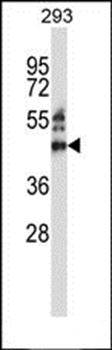 ZNF660 antibody