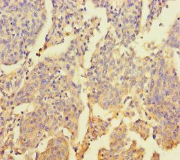 ZNF662 Antibody