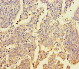 ZNF662 antibody