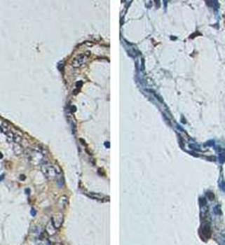 ZNF668 Rabbit Polyclonal Antibody