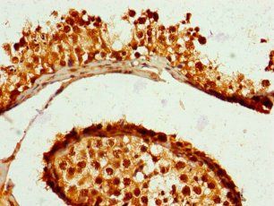 ZNF679 Antibody