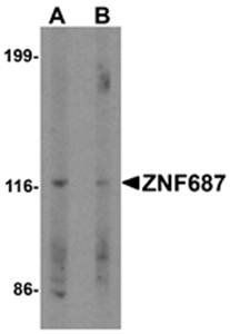 ZNF687 Antibody