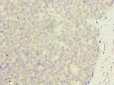 ZNF688 Antibody