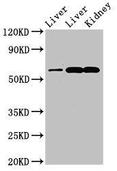 ZNF695 antibody