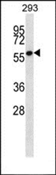 ZNF697 antibody