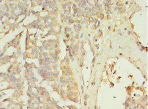 ZNF699 Antibody