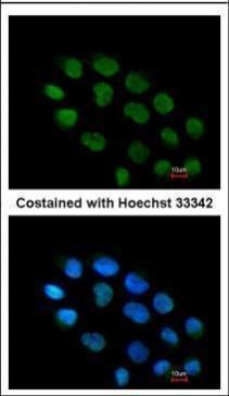 ZNF7 Rabbit Polyclonal Antibody