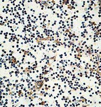 ZNF701 Rabbit Polyclonal Antibody