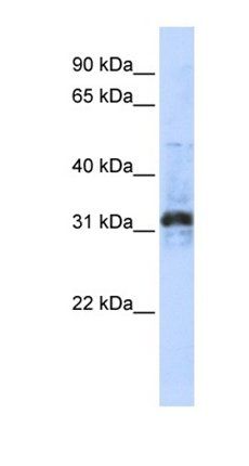 ZNF705D antibody