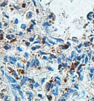 ZNF706 Rabbit Polyclonal Antibody