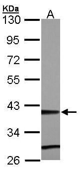 ZNF707 Rabbit Polyclonal Antibody