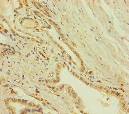 ZNF71 Antibody