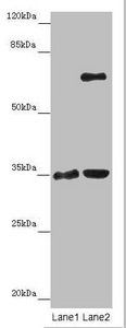 ZNF75A Antibody