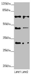ZNF785 Antibody