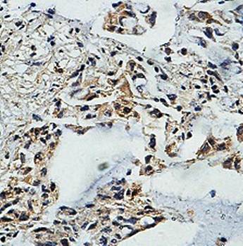 ZNF786 Rabbit Polyclonal Antibody