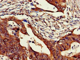 ZNF816 Antibody