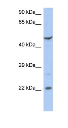 ZNF826P antibody