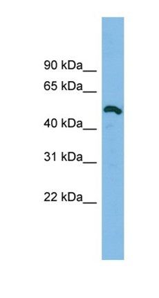 ZNF829 antibody