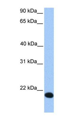 ZNF833P antibody