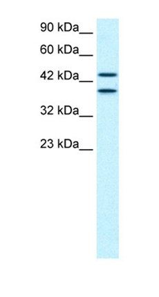 ZNF839 antibody