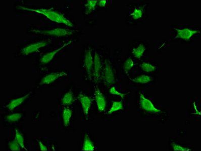 ZNF98 Antibody