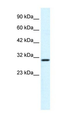 ZNHIT6 antibody