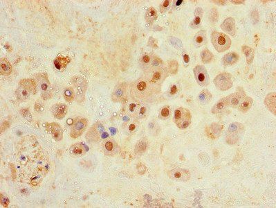 SLC30A8 Antibody