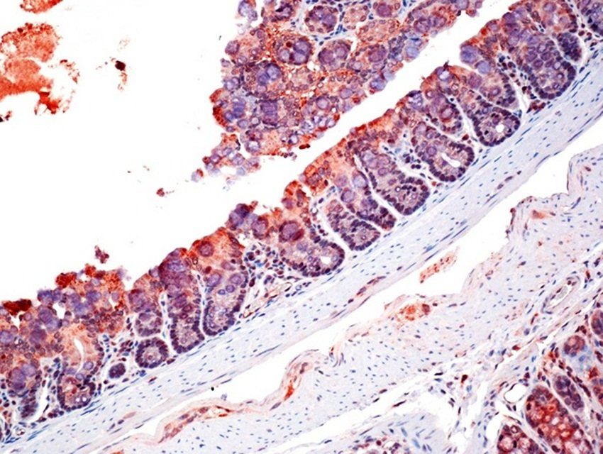 ZO-1 antibody