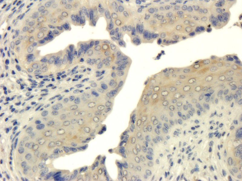 ZO-1 antibody