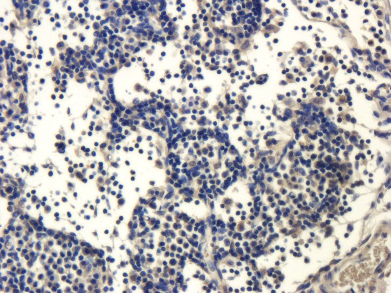 ZO-1 Rabbit Polyclonal Antibody