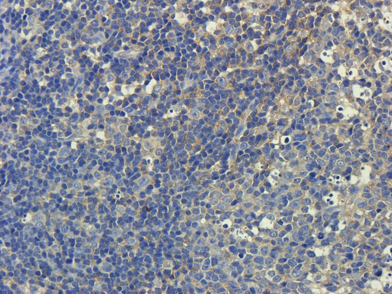 ZO-1 antibody