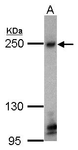 ZO-1 Rabbit Polyclonal Antibody