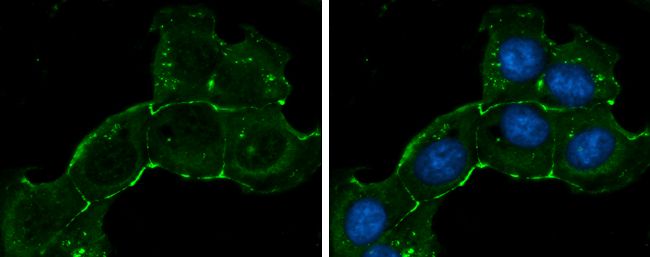 ZO1 antibody