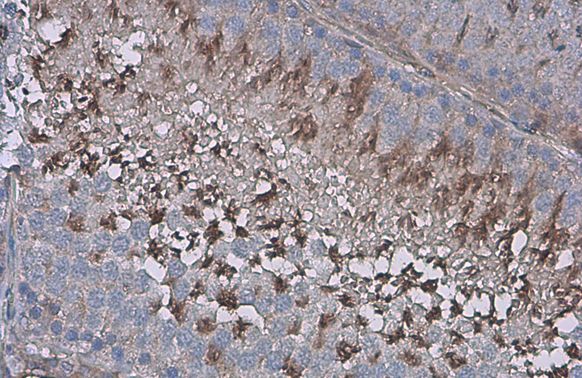 ZPBP Rabbit Polyclonal Antibody