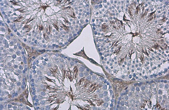 ZPBP Rabbit Polyclonal Antibody