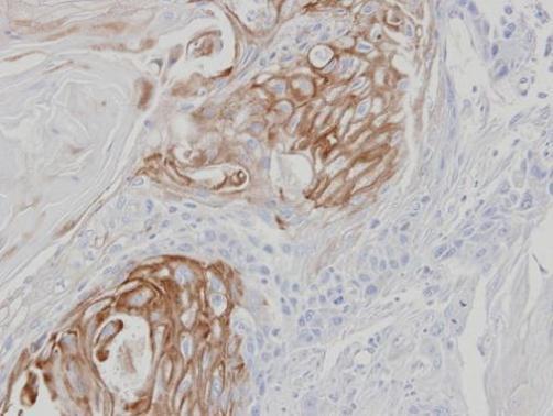 ZPBP Rabbit Polyclonal Antibody