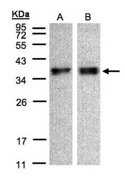 zona pellucida binding protein isoform 1 antibody