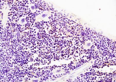 SERPINA10 Rabbit Polyclonal Antibody