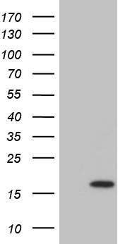 ZRANB1 Antibody