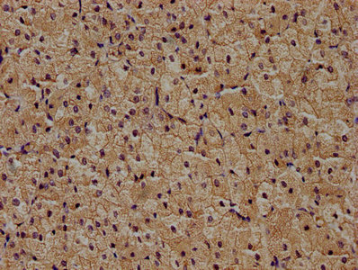 ZRANB1 antibody