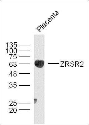 ZRSR2 antibody