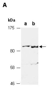 ZSCAN10 antibody