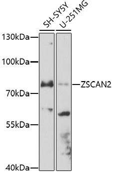 ZSCAN2 antibody