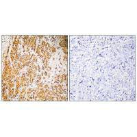ZSCAN22 Antibody