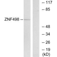 ZSCAN25 antibody
