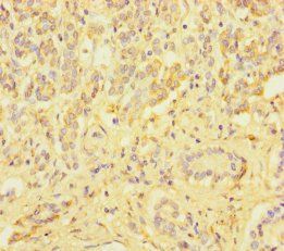 ZSCAN29 Antibody