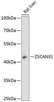ZSCAN31 antibody