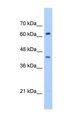 ZSCAN5D antibody